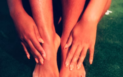 Cracked Heel Treatment